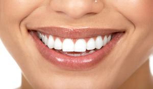 Instant Tooth Whitening